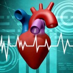Myocardial Infarction (Heart Attack)