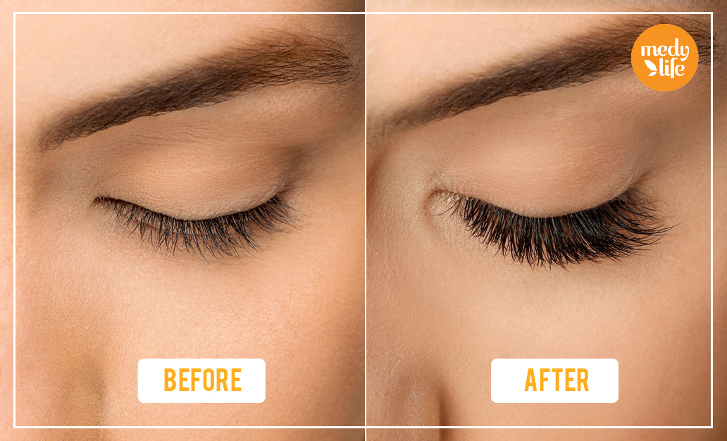 How to Grow Eyelashes Fast in a with Natural Home Remedies?