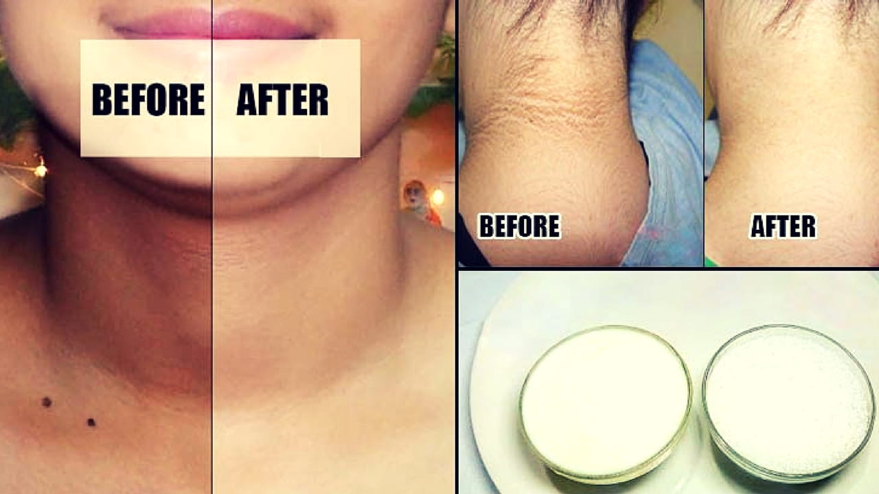 How to Get Rid of a Dark Neck in 20 Minutes? - Medy Life