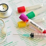 Hepatitis