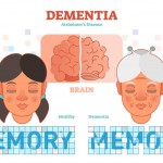 Alzheimer’s Disease