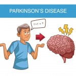 Parkinson’s Disease