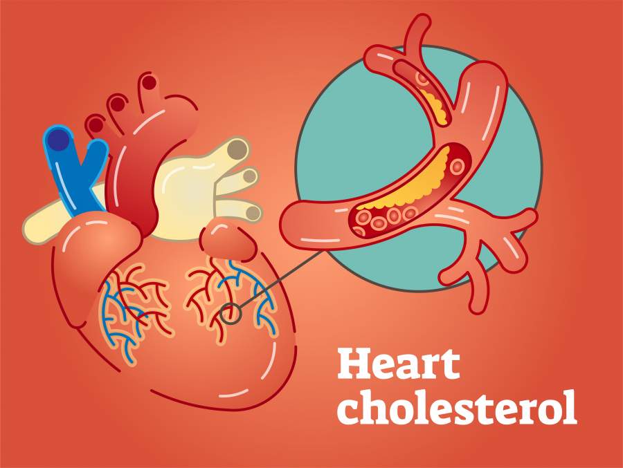 Super Foods to Keep LDL Cholesterol Low