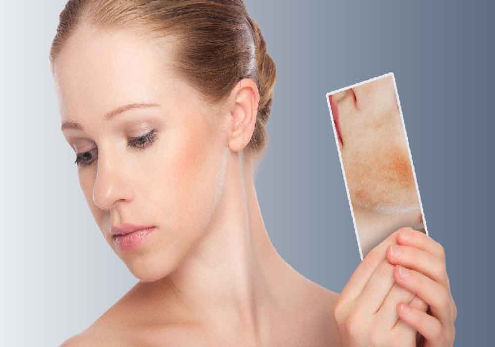 Symptoms and Problems of Combination Skin !