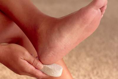 How to take Care of Cracked Heels Naturally ?