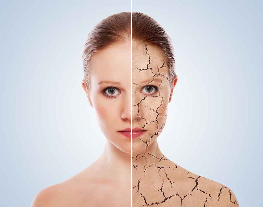 Simple remedies to overcome Dried out skin !