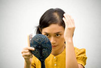 Are you suffering From Hair Loss ?