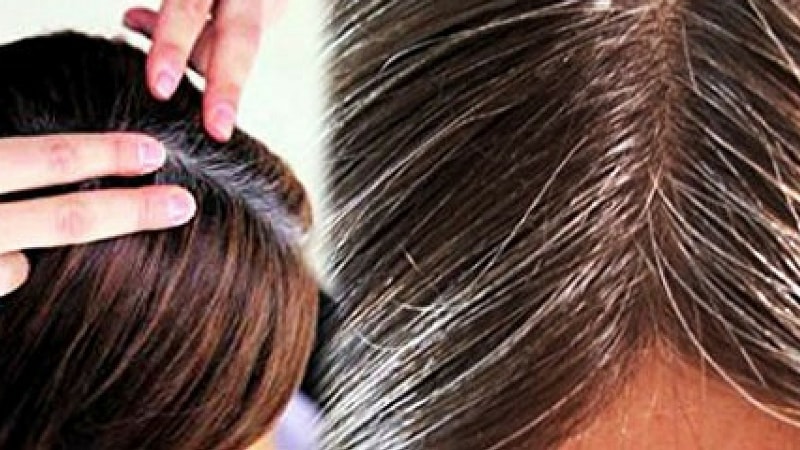 Fed up of white hair? Try these tips to get rid of white hair!