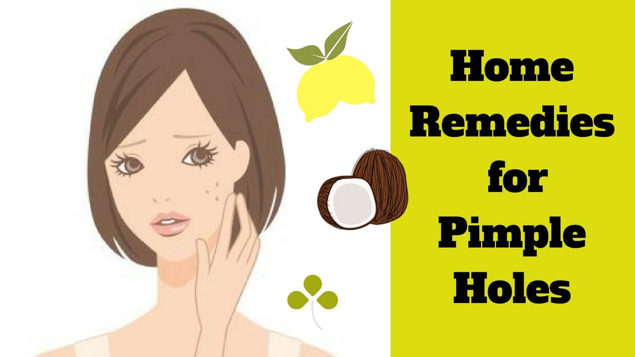 7 Easy and Quick Home Remedies To Get Rid Of Pimple Holes