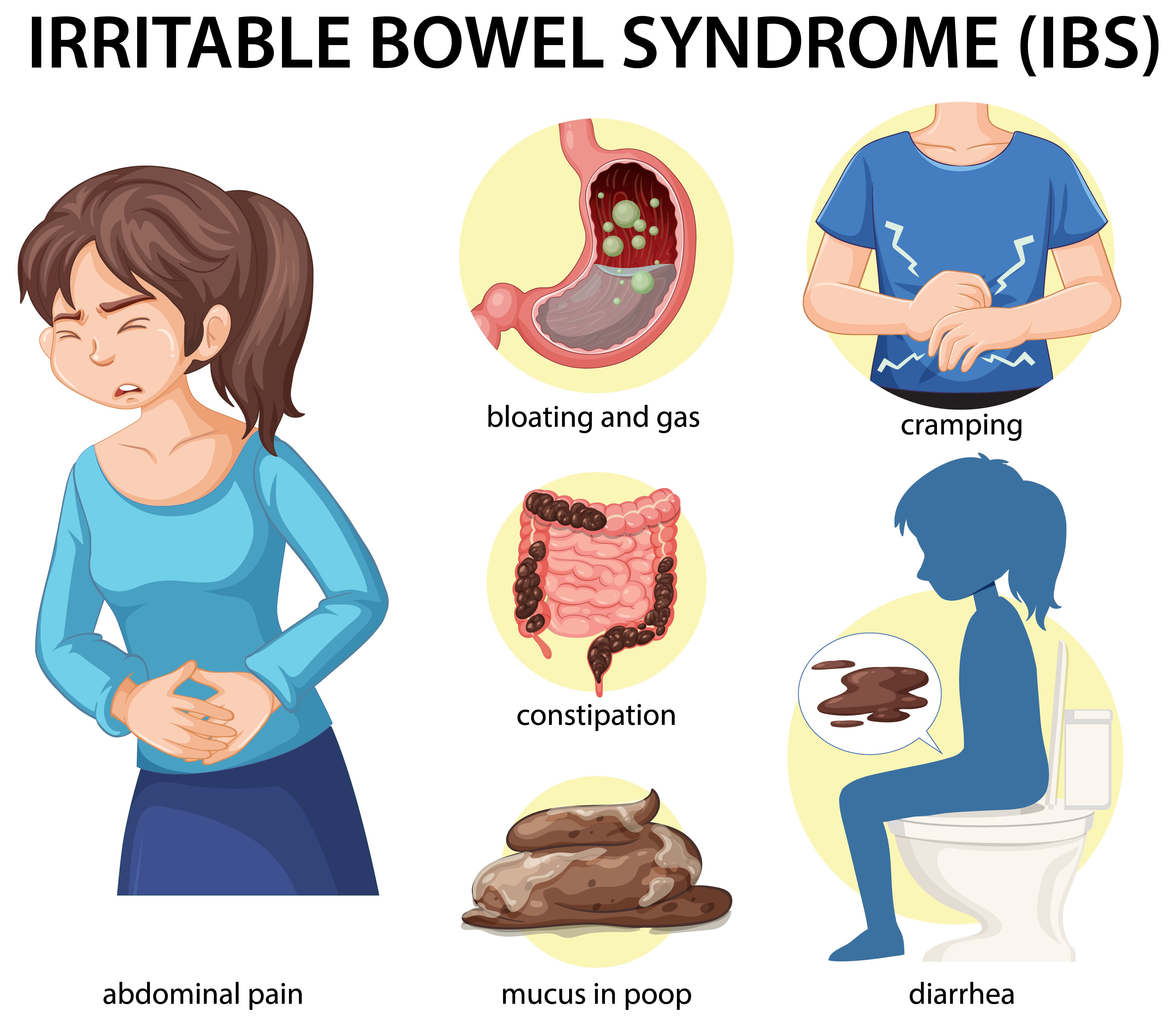 Causes, Symptoms and Treatment of Irritable Bowel Syndrome