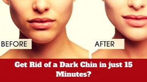 Get Rid of a Dark Chin