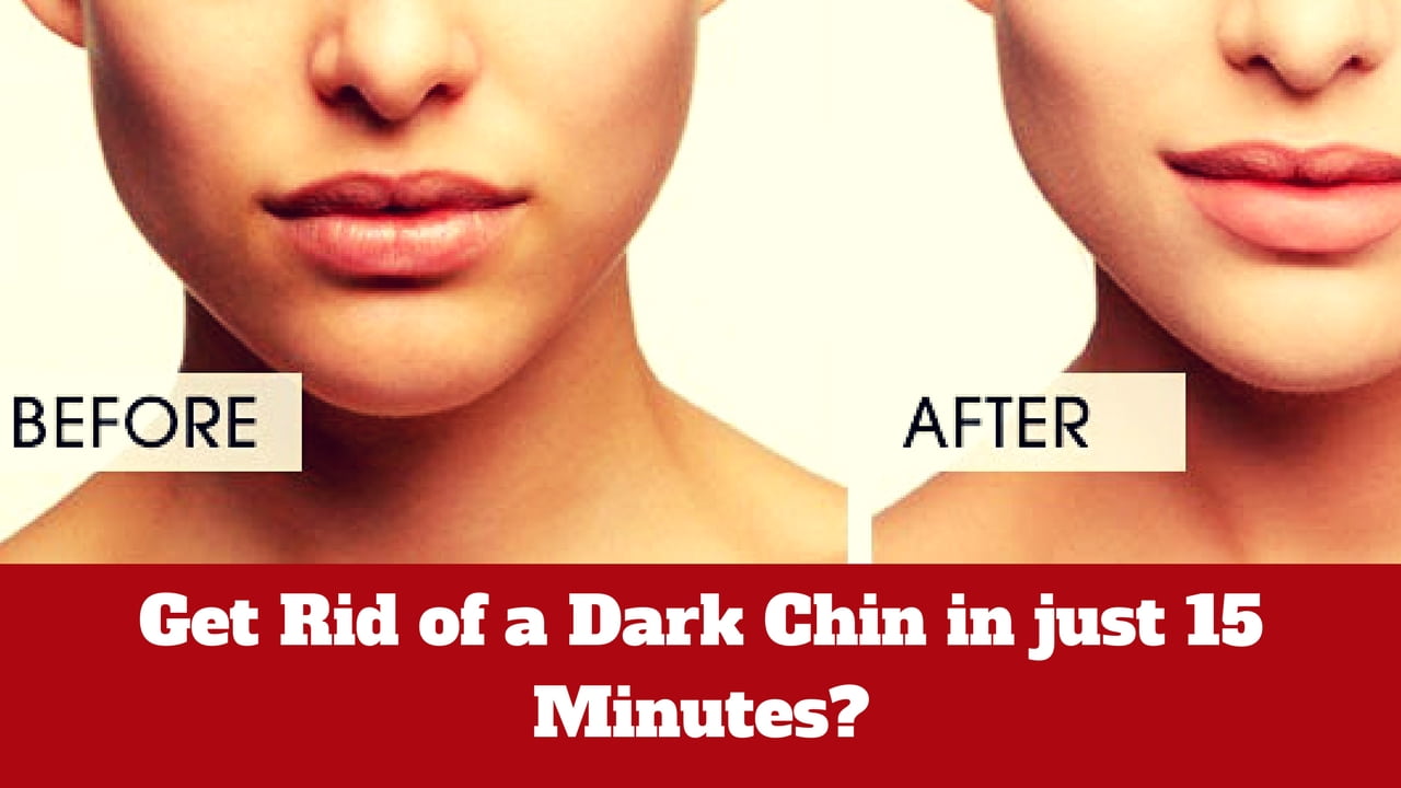 How to Get Rid of a Dark Chin in just 15 Minutes?
