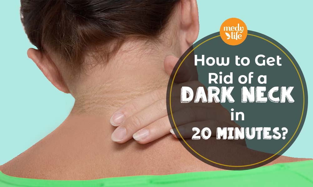 How to Get Rid of a Dark Neck in 20 Minutes?