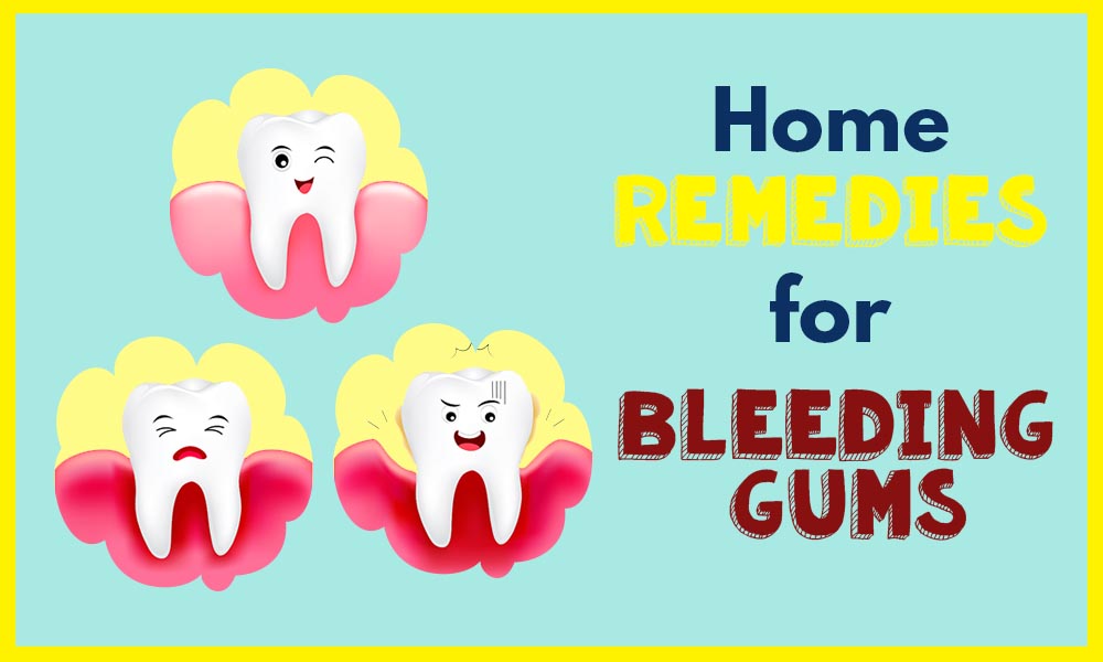 Do your Gums Bleed? Try These Home Remedies for Bleeding Gums
