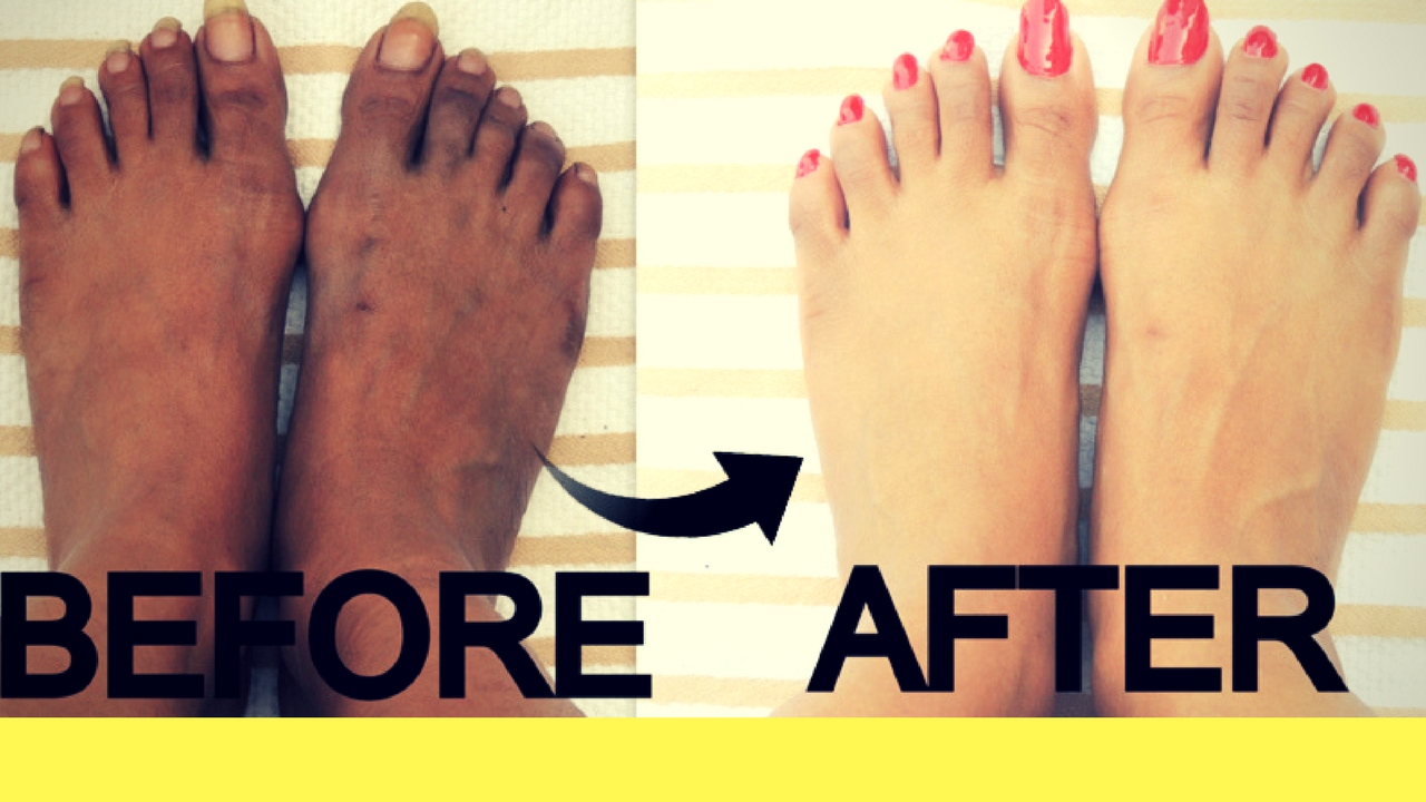 How to Whiten Feet in 20 Minutes?