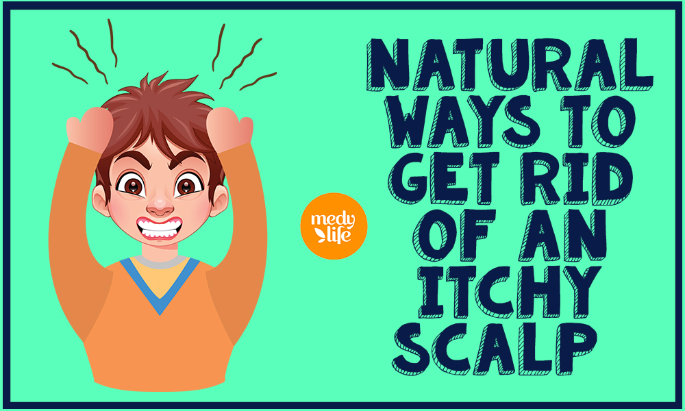 The Best ways to Get rid of an Itchy Scalp Naturally!