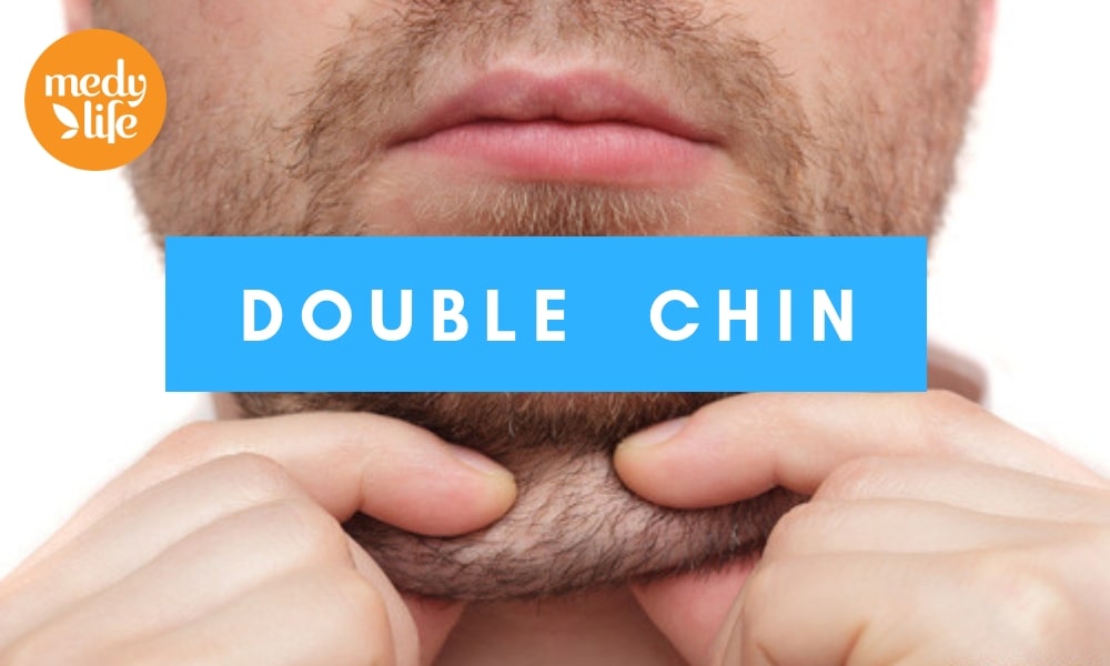 10 Smart and Simple Tricks to Hide a Double Chin